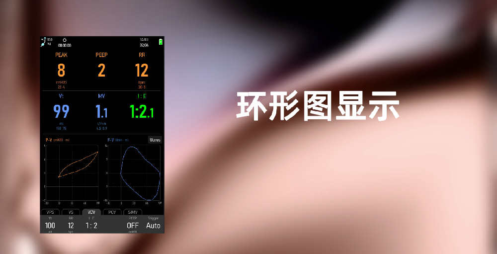 全新环形图显示功能，助力更先进的通气监测