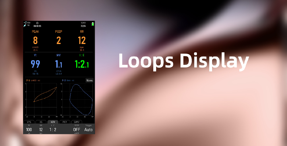 Introducing Loop Display for Advanced Ventilation Monitoring